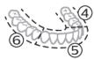 PHILIPS HX9911/88 - BrushPacer - 2