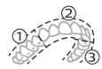PHILIPS HX9911/88 - BrushPacer - 1
