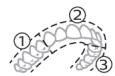 PHILIPS HX9911/88 - BrushPacer - 1