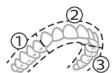 PHILIPS HX9911/88 - BrushPacer - 1