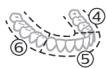 PHILIPS HX9911/88 - BrushPacer - 2