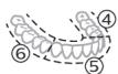 PHILIPS HX9911/88 - BrushPacer - 2