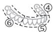 PHILIPS HX9911/88 - Instructions de brossage - 7