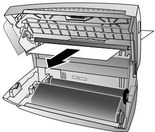 PHILIPS MAGIC 5 VOICE (PPF675E/FRB) - Éliminer le bourrage de papier - 3