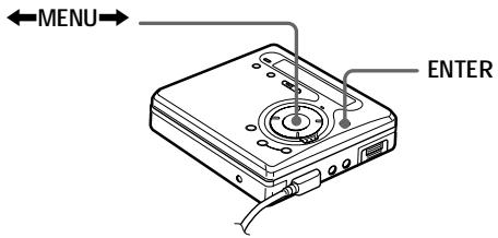 SONY Migl MDLP WheMALKTANMZ-G750/G750PC/G750DPC - Renforcement des graves (DIGITAL MEGA BASS) - 1