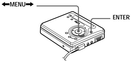 SONY Migl MDLP WheMALKTANMZ-G750/G750PC/G750DPC - Lecture de plages répétée - 1