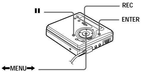 SONY Migl MDLP WheMALKTANMZ-G750/G750PC/G750DPC - Remarque - 1