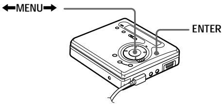 SONY Migl MDLP WheMALKTANMZ-G750/G750PC/G750DPC - Vérification de la durée restante ou de la position de lecture - 1