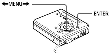 SONY Migl MDLP WheMALKTANMZ-G750/G750PC/G750DPC - Enregistrement sans écraser les données existantes - 1