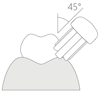 Xiaomi BROSSEADENTSMITOOTHBRUSH T500 - brossage sain - 1