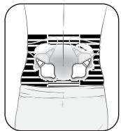 OMRON HeatTens - Étape 1 - placement des électrodes - 2