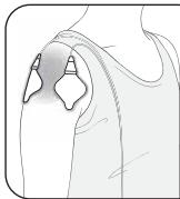 OMRON HeatTens - Épaule - 1