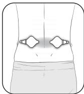 OMRON HeatTens - Étape 1 - placement des électrodes - 4