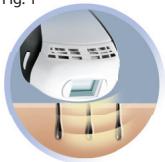 REMINGTON iPL6250 - DÉCOUVRIR L'i-LIGHT - 1