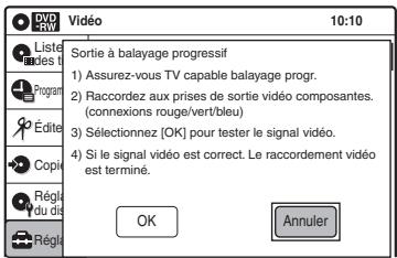 SONY RDR-VX410 - Progressif - 1