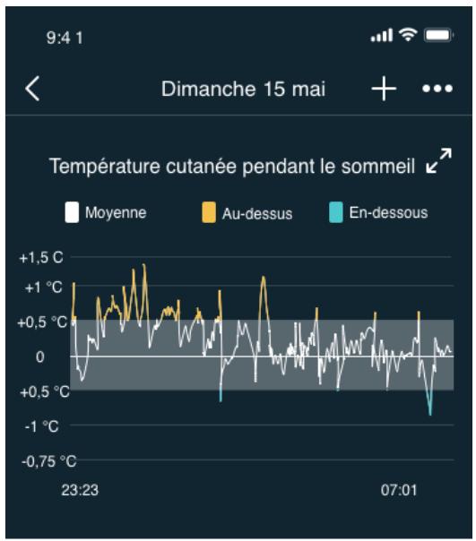 FITBIT SENSE2 - Suivre vos variations de température cutanée - 4
