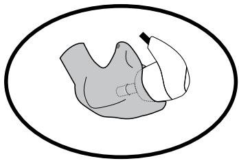 SHURE SHU SE420 - Manchons d'écouteur personnalisés - 1