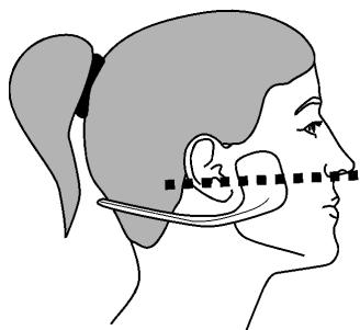 SLENDERTONE FACE POUR FEMME - POSITIONNEMENT CORRECT DES COUSSINETS - 1