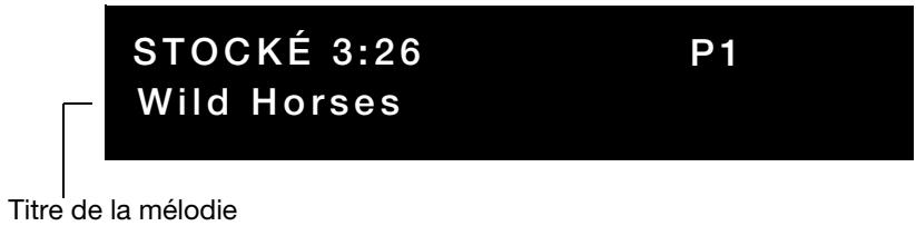 BOSER 3.2.1 GSX - Lecture de musique stockée - 3