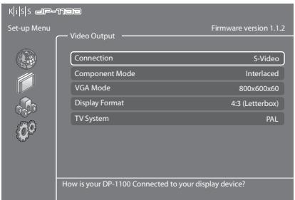 KISS DP 1100 - Sortie vidéo - 1