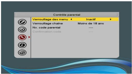 SAGEMCOM DT83HD - Régler le bandeau - 1