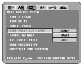 DENON DVD-2200 - Remarque: - 2