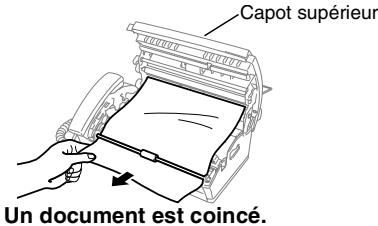 BROTHER FAX T104 F1 - Bourrage de documents - 2
