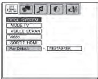 SOUNDVISION SV200W BLANC - Défaut - 1