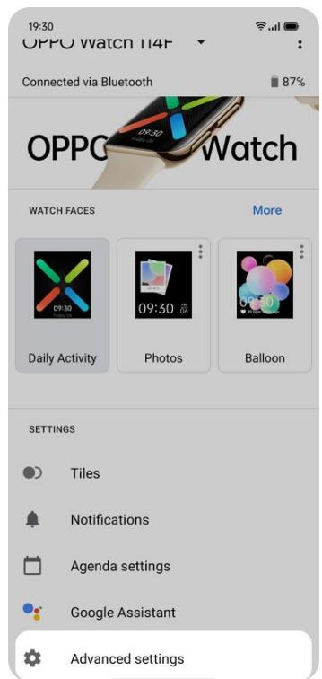 OPPO watch rose 41mm - Désappairer OPPO watch - 1