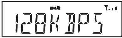 ROBERTS ORTUS2 - Options d'affichage - DAB cont. - 2