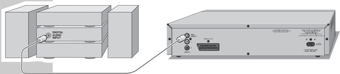 GRUNDIG GDP3200 - Raccordement de la chaîne hi-fi avec son stéréo à deux canaux (PCM) - 1