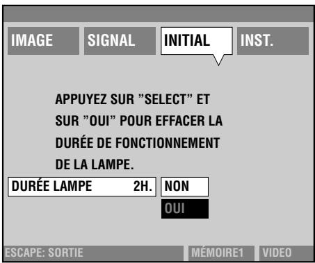 YAMAHA DPX-1 - [Groupe d'opérations D] - 2