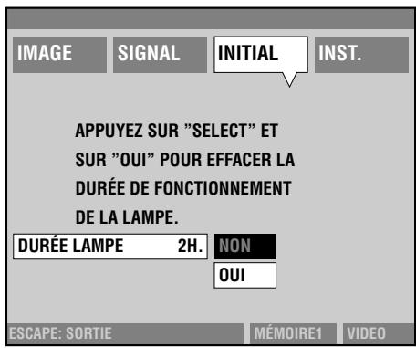 YAMAHA DPX-1 - [Groupe d'opérations D] - 3