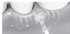 PANASONIC EW1611 W503 - Nettoyage des dents - 3