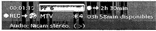 THOMSON DTH8043 - Enregistrer le programme en cours - 2
