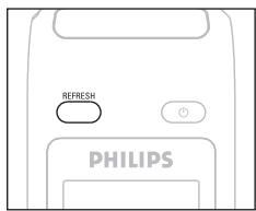 PHILIPS WAS7500 - Télécommande bidirectionnelle - 1
