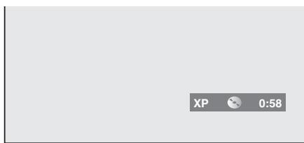 TOSHIBA DR265 - Enregistrement simple - 3