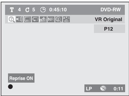TOSHIBA DR265 - 2) Appuyez sur [STOP ] une fois pour arrêté la lecture. - 1