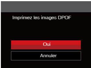 KODAK FZ102 - Imprimez les images DPOF - 1