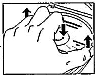 PHILIPS 7180 - Retrait du CD - 2