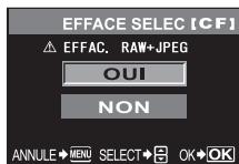 OLYMPUS NC - Effacement des vues selectionnées - 1
