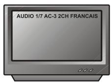 PEEKTON PK 6005 MKII - Fonction AUDIO - 3