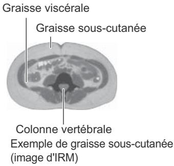 OMRON NC - Qu'est-ce que le muscle squelettique ? - 2