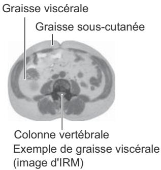 OMRON NC - Qu'est-ce que le muscle squelettique ? - 1