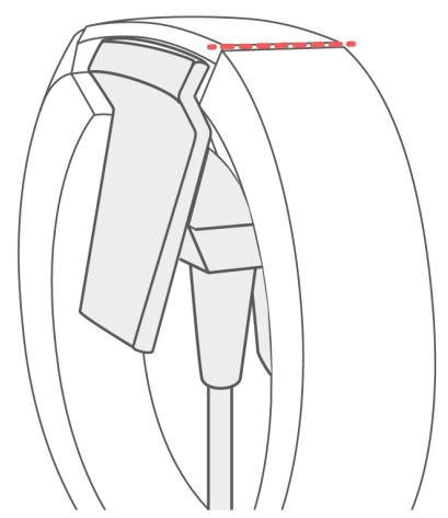 FITBIT L4301382 - Comportement imprévisible - 2