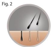 REMINGTON iLIGHT iPL 6780cob - A qui fait-il s'attendre lors de l'utilisation de l'i-Light - 1