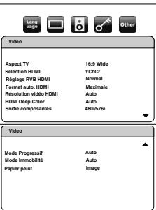 DENON BD7003 - Vidéo - 1
