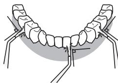 PANASONIC EW-DJ40 W503 - Face antérieure des dents... - 1