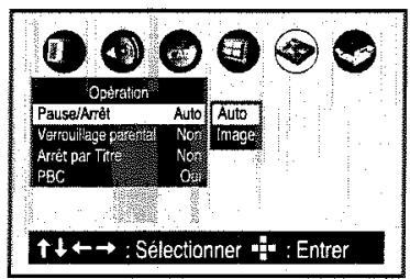 TOSHIBA SD 22 VE - Pause/Arrêt - 2
