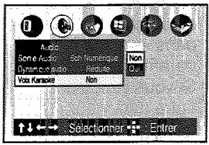 TOSHIBA SD 22 VE - Karaoke - 1